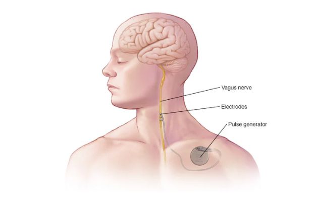 vagus nerve